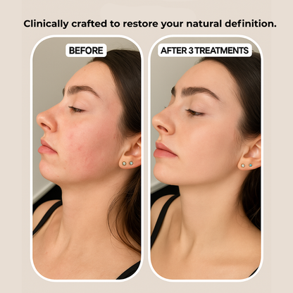 Collagen Lifting V Mask