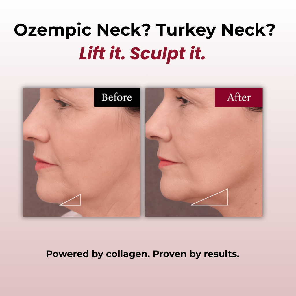 Collagen Lifting V Mask