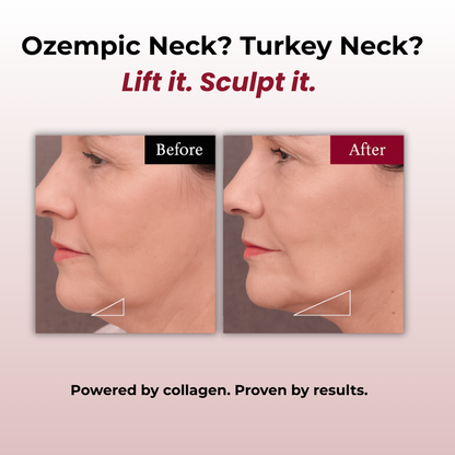 Collagen Lifting V Mask